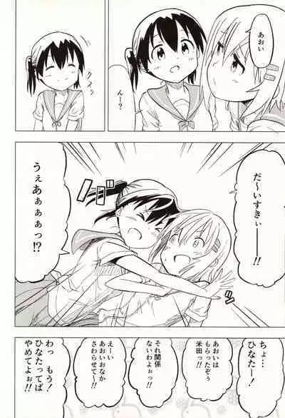 Slur Staccato Days 1