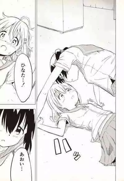 Slur Staccato Days 1