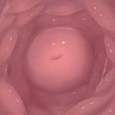 [Purekonkon] Unbirth