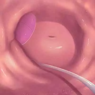 [Purekonkon] Unbirth