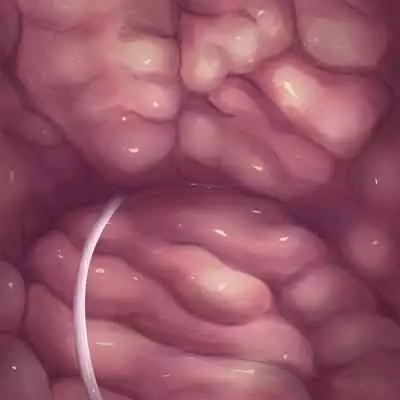 [Purekonkon] Unbirth