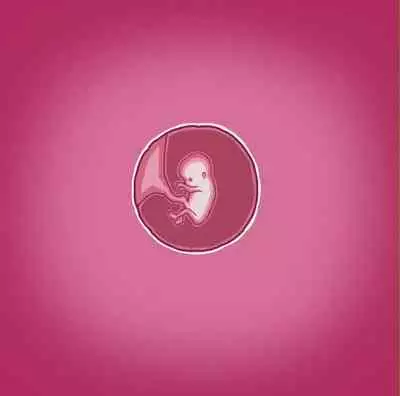 [Straw] Yumi's Study Abroad (Week 24) [English] (On-going) [a2Translation]