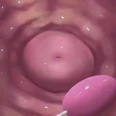 [Purekonkon] Unbirth